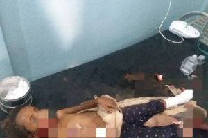 إصابة طفلتين وامرأة بانفجار لغم حوثي في حيس بالحديدة