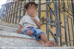 إصابة طفلة بانفجار لغم حوثي جنوبي الحديدة اليمنية