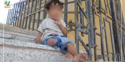 إصابة طفلة بانفجار لغم حوثي جنوبي الحديدة اليمنية
