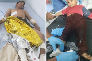 انفجار مقذوف من مخلفات الحوثي في 3 أطفال شمال الضالع