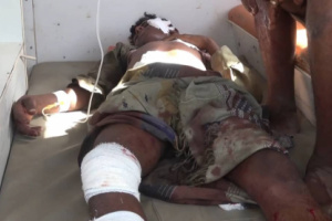 إصابة مواطن بجروح خطيرة بانفجار لغم حوثي شرق حيس