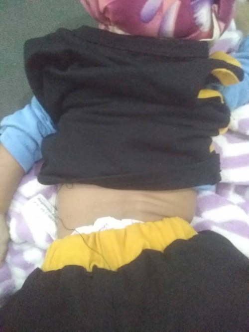 إصابة اربعة مواطنين، بينهم طفل وامرأة؛ إثر قصف لمليشيات الحوثي على حيس