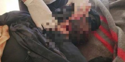 استشهاد أم برصاص قناص حوثي على أطراف الحد بيافع