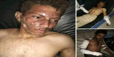 أحرقهم أحياء بغرفة مغلقة وهرب.. جريمة مروعة تهز هذه المحافظة