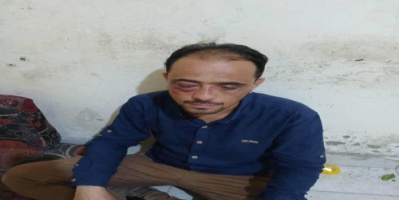 نجل قائد محور تعز يختطف رجل أعمال ويعتدي عليه بوحشية ويسحله إلى تحت أقدام تاجر.. تفاصيل