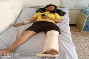 قناص حوثي يصيب مزارعًا أعزل في قعطبة والضحايا المدنيون في ازدياد