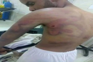 شاهد دهس واختطاف وتعذيب.. وادي عبيدة يهتز على وقع جريمة بشعة وسط صمت سلطات مأرب