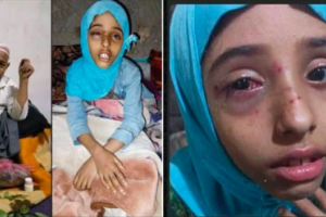 مُسن يُقدم على ضرب طفلة بشكل وحشي عقب شجارها مع حفيده