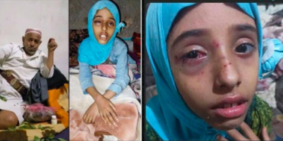 مُسن يُقدم على ضرب طفلة بشكل وحشي عقب شجارها مع حفيده