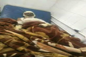 صرخة بالنار في وجه الجوع.. مواطن يشعل جسده في الحديدة احتجاجاً على جحيم الحوثي