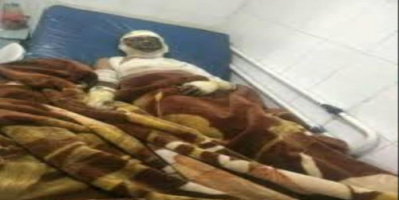 صرخة بالنار في وجه الجوع.. مواطن يشعل جسده في الحديدة احتجاجاً على جحيم الحوثي
