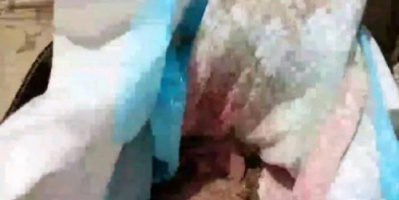تقشعر لها الأبدان: ذبحوا رضيعة ودفنوها في كرتون خلف مستشفى بالضالع وكشفتهم امرأة مسنة