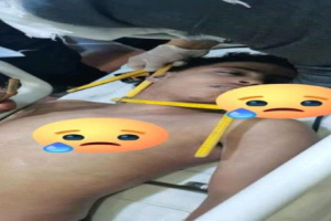 مشعوذ يقتل شابًا في إب بـ"علاج قرآني".. داسته قدمه حتى لفظ أنفاسه