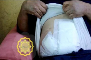 فوضى عائلية تتحول لجريمة دموية في صنعاء: شقيق يطعن أخاه بعد رؤيته ابنته تركب تاكسي بدون محرم