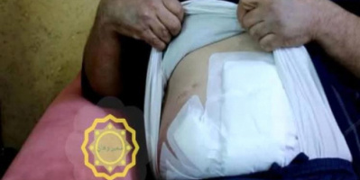 فوضى عائلية تتحول لجريمة دموية في صنعاء: شقيق يطعن أخاه بعد رؤيته ابنته تركب تاكسي بدون محرم