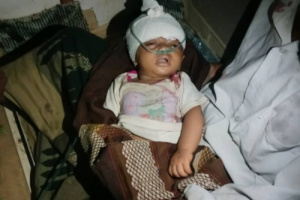 إصابة طفل رضيع بقصف صاروخي حوثي في مقبنة
