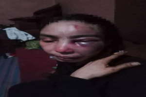 امرأة تُعذب بوحشية على يد طليقها العسكري أمام الناس في تعز 