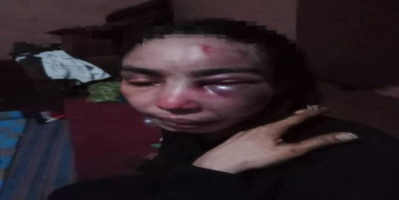 امرأة تُعذب بوحشية على يد طليقها العسكري أمام الناس في تعز 