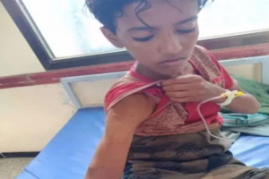 قناص حوثي يصيب جسد طفل برصاص الغدر أثناء رعيه الأغنام بلحج