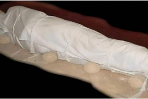 فتاة تعود للحياة أثناء الصلاة عليها جنوب صنعاء