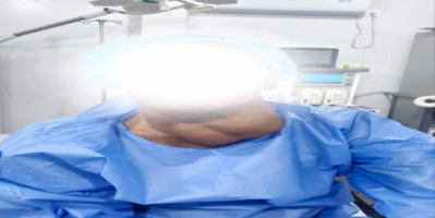 المخا.. فريق طبي ينجح في استئصال ورم كبير بالغدة الدرقية لمواطن يعاني منذ 20 عام