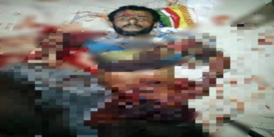 تعذيب وحشي لمواطن على يد عناصر حزب الإصلاح بمعسكر الصدرين