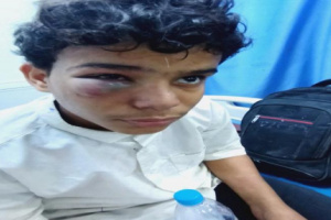 أفارقة يعتدون بوحشية على طفل في المكلا.. ومنشور مؤلم لوالده من خارج اليمن