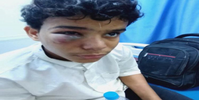 أفارقة يعتدون بوحشية على طفل في المكلا.. ومنشور مؤلم لوالده من خارج اليمن