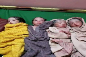 ولادة نادرة في صنعاء لأم وضعت 4 توائم دفعة واحدة