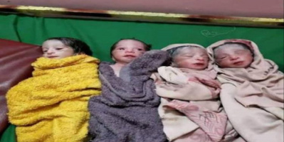 ولادة نادرة في صنعاء لأم وضعت 4 توائم دفعة واحدة