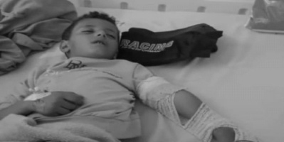 دخل بصحة جيدة وخرج جثة هامدة.. وفاة طفل بعد خضوعه لعملية بسيطة بيده بمدينة إب