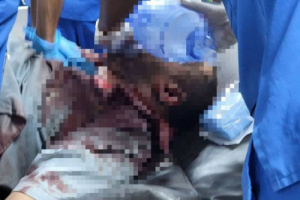 استشهاد المواطن حمزة العولقي بإطلاق نار مباشر في عتق