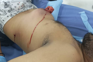 عاجل : وصول جرحى من المتظاهرين السلميين أمام بوابة معاشيق الى مستشفى عبود العسكري