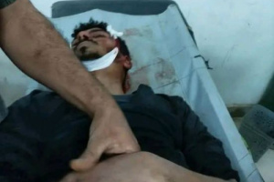 استشهاد شاب من الأزارق خلال مواجهات مع المليشيا الحوثية