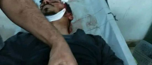 استشهاد شاب من الأزارق خلال مواجهات مع المليشيا الحوثية