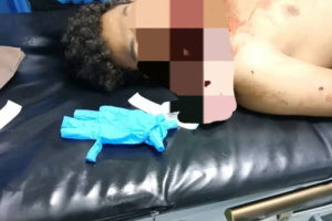 محافظ الضالع يوجه بسرعة القبض على المتهم بمقتل شخص في سوق سناح