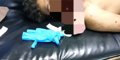 محافظ الضالع يوجه بسرعة القبض على المتهم بمقتل شخص في سوق سناح