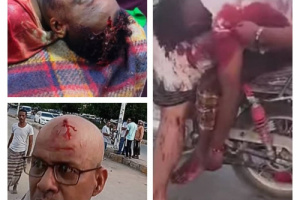 الشبكة المدنية تدين استخدام الرصاص الحي ضد متظاهرين سلميين في المكلا وسقوط قتلى وجرحى