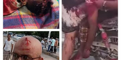 الشبكة المدنية تدين استخدام الرصاص الحي ضد متظاهرين سلميين في المكلا وسقوط قتلى وجرحى