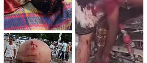 الشبكة المدنية تدين استخدام الرصاص الحي ضد متظاهرين سلميين في المكلا وسقوط قتلى وجرحى