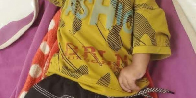 مناشدة عاجلة لإنقاذ حياة طفل تعرض لإصابة خطيرة عقب سقوطة من الدور الرابع 