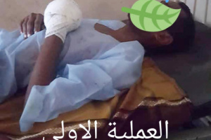 مناشدة إنسانية لإنقاذ شاب أصيب بانفجار دبة فريون أثناء عمله في ورشة تكييف