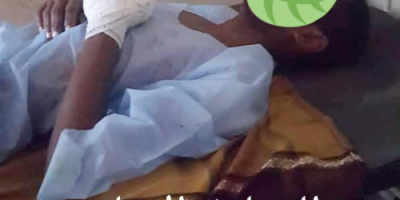 مناشدة إنسانية لإنقاذ شاب أصيب بانفجار دبة فريون أثناء عمله في ورشة تكييف