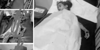 عاجل .. فاجعة مروعة تهز الضالع.. سقوط أطفال بين شهيد وجريح بانفجار من مخلفات الحوثي