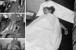 عاجل .. فاجعة مروعة تهز الضالع.. سقوط أطفال بين شهيد وجريح بانفجار من مخلفات الحوثي