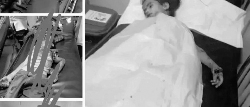 عاجل .. فاجعة مروعة تهز الضالع.. سقوط أطفال بين شهيد وجريح بانفجار من مخلفات الحوثي
