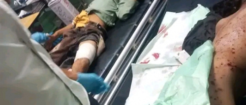 انتقالي الضالع ينعي شهداء حجر ويؤكد أن دماء الأطفال تفضح المشاريع المعادية للجنوب (بيان)