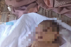 طفلة من المضاربة ضحية قصف حوثي